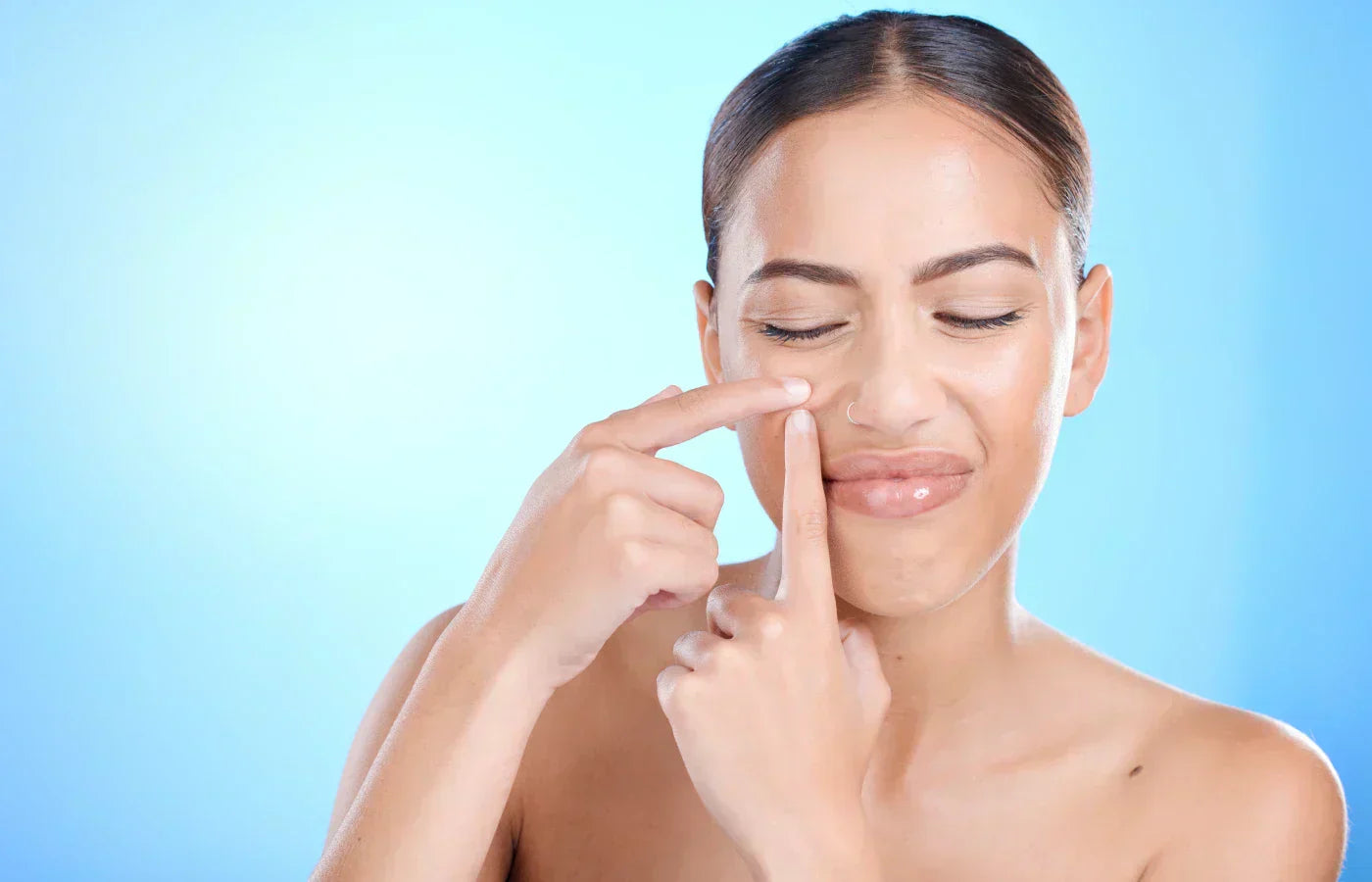 Mitesser und Komedonen sicher und effektiv entfernen