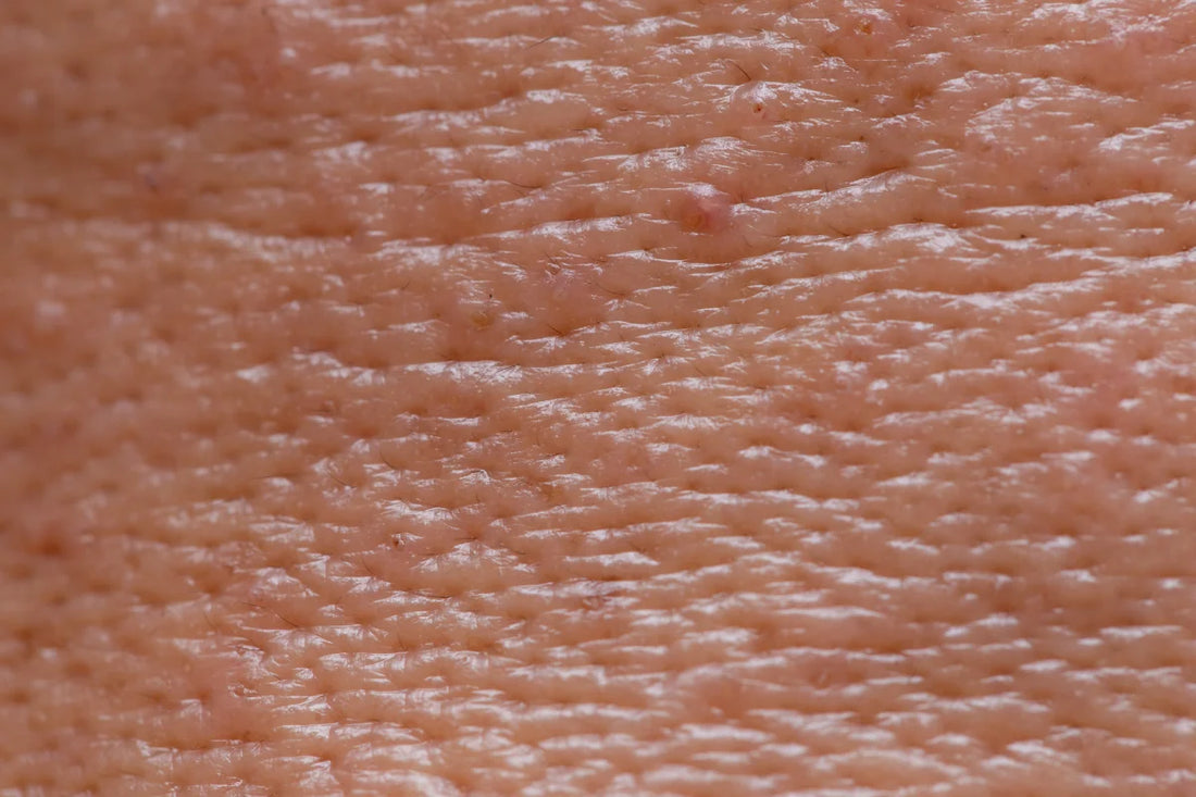 Gesichtspflege für fettige Haut